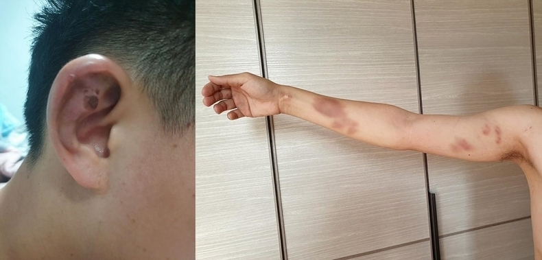 과거 B 팀장의 학대 의혹(사진 왼쪽)과 C 교사의 학대 의혹 ⓒ노조·한터