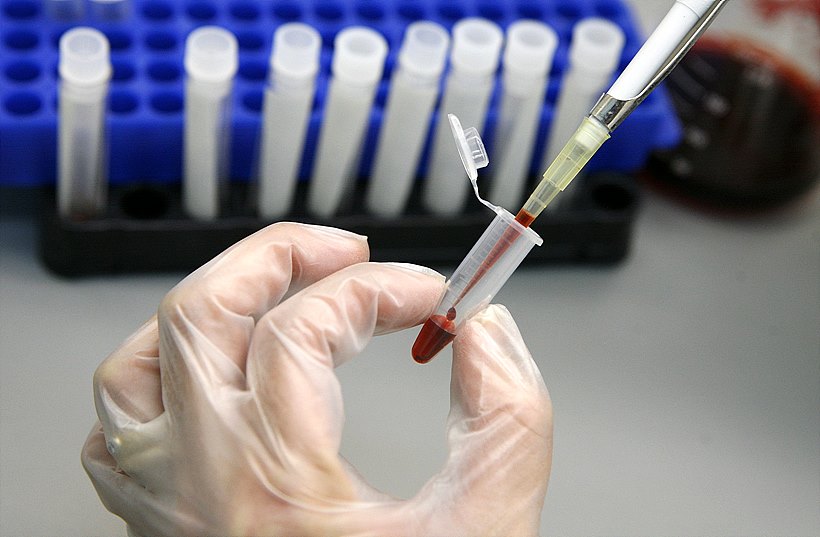 최근 HIVAIDS 국내 감염자가 갈수록 늘고 있어 각별한 주의가 요구된다.