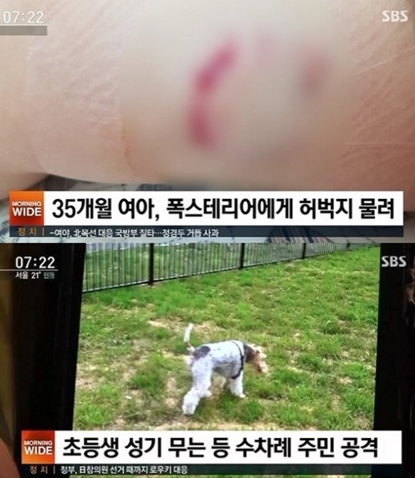 (사진: SBS 뉴스) ▲ (사진: SBS 뉴스)